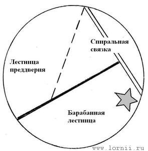 Рис. 2. Положение каудальной кохлеостомы по отношению к базилярной мембране и спиральной связке.