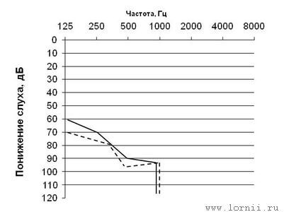 Диаграмма  2. - Уровни восприятия чистых тонов до и после КИ у пациентов с остаточным слухом на оперированном ухе