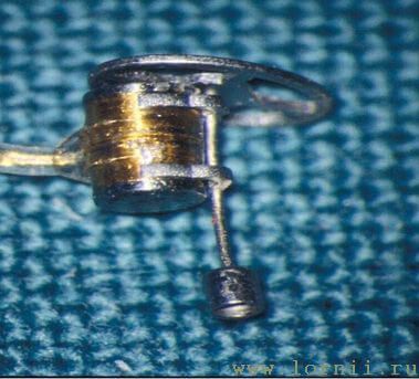 Рис.17. Фиксация катушки на полный протез