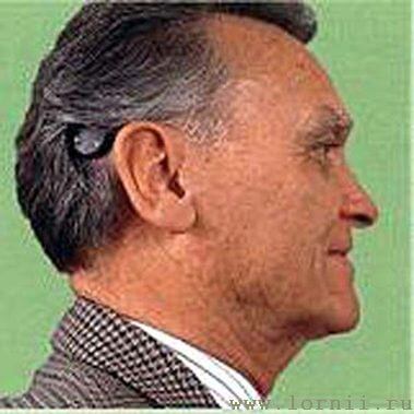 Рис.5. Место крепления аудиопроцессора