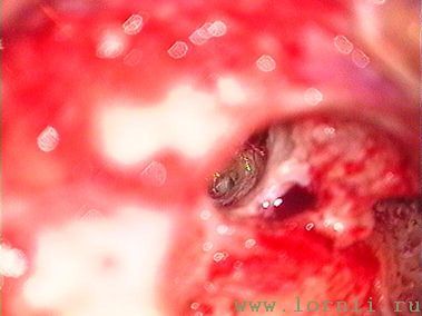 Рис.13. Ниша окна улитки